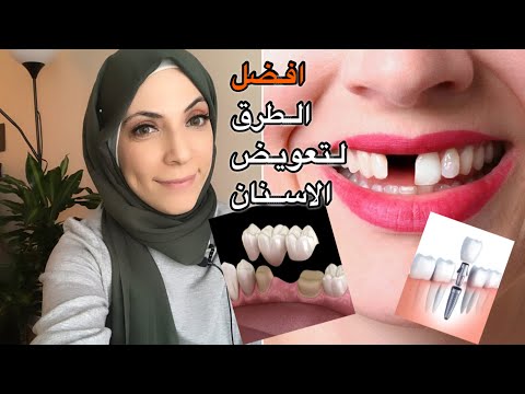 فيديو: ما هي أفضل طريقة للتعويض