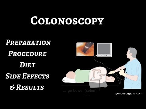 Colonoscopy, preparation, procedure, diet, Side effects and results