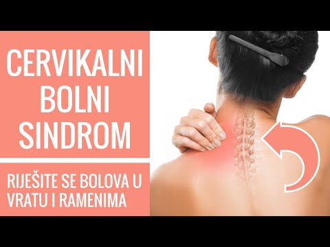 Video: Sternocleidomastoidni Bol: Uzroci, Simptomi I Liječenja