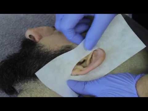 JD Waxing -  Men's Ear Waxing Treatment
