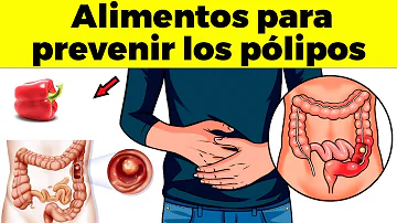 ¿Qué vitaminas son buenas para los pólipos de colon?