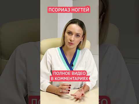 Псориаз НОГТЕЙ - симптомы и признаки 📌 Ногти при псориазе