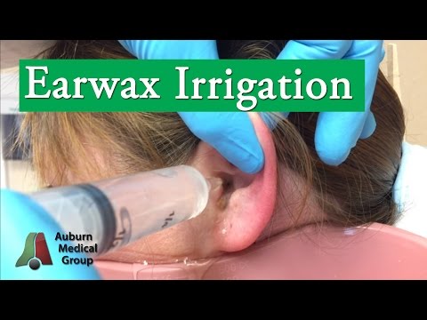 Ear Wax Irrigation | Auburn Medical Group