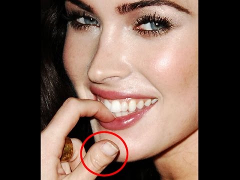 top 10 celebrities with physical deformities youtube