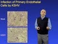 Don Ganem (Novartis Institutes for Biomedical Research) Part 3: KSHV Latency and KS Pathogenesis