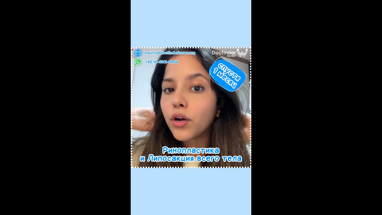 Сколько стоит ринопластика и липосакция всего тела в Корее? Мой честный ...