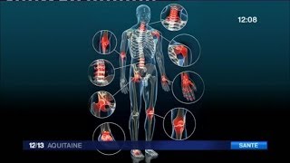 Quels solutions pour soulager les douleurs liées à l'arthrose ?