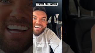 VENEERS GONE WRONG #veneers Wealth