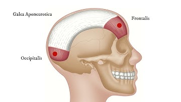 Epicranius - How To Find Trigger Points (for Headache)