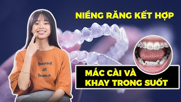 Niềng Răng Trong Suốt Và Mắc Cài 2 Trong 1 Của Cô Gái Bị Hô Răng | Bác Sĩ Nam Bùi Vinalign