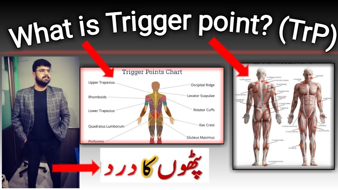 What is Trigger point ? | Muscle Pain? | An easy guide of for the ...