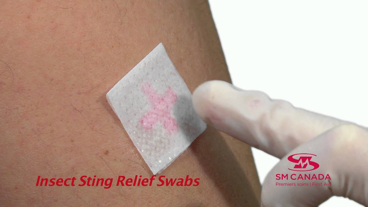 Insect Sting Relief Swabs YouTube