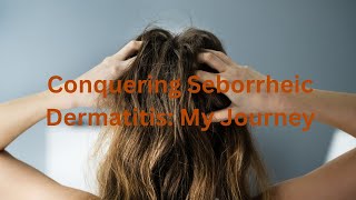 Cured?! My Journey with Seborrheic Dermatitis Treatment 🌟 by Sharri K 4,074 views 1 year ago 3 minutes, 49 seconds