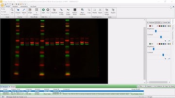 Normalization Using Housekeeping Protein | Normalization Strategies