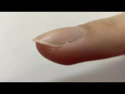 how to get rid of a hangnail without nail clippers