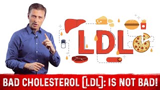 What is LDL Cholesterol? – Dr.Berg on LDL Bad Cholesterol (Part 4)