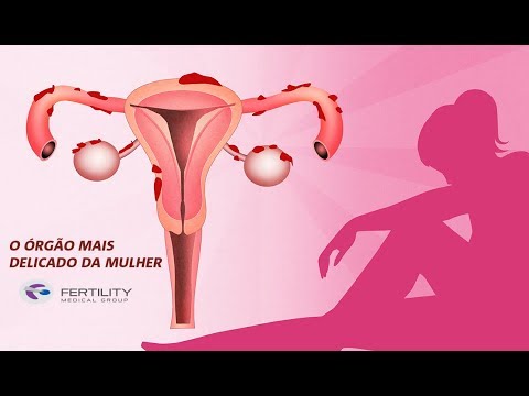 Vídeo: Uma mulher com uma trompa de Falópio pode dar à luz?