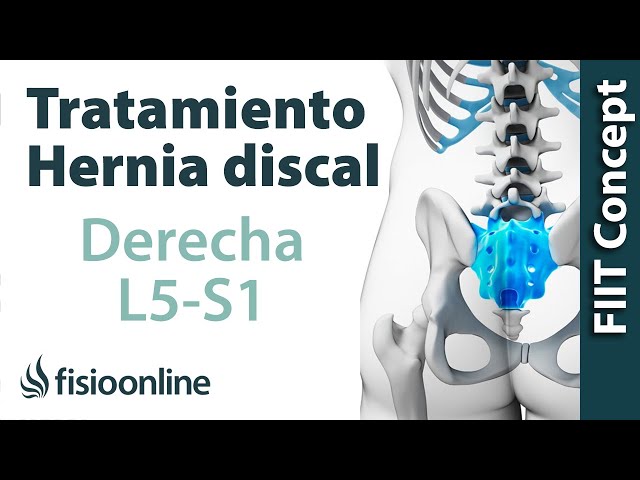 L5 s1 cronica radiculopatia