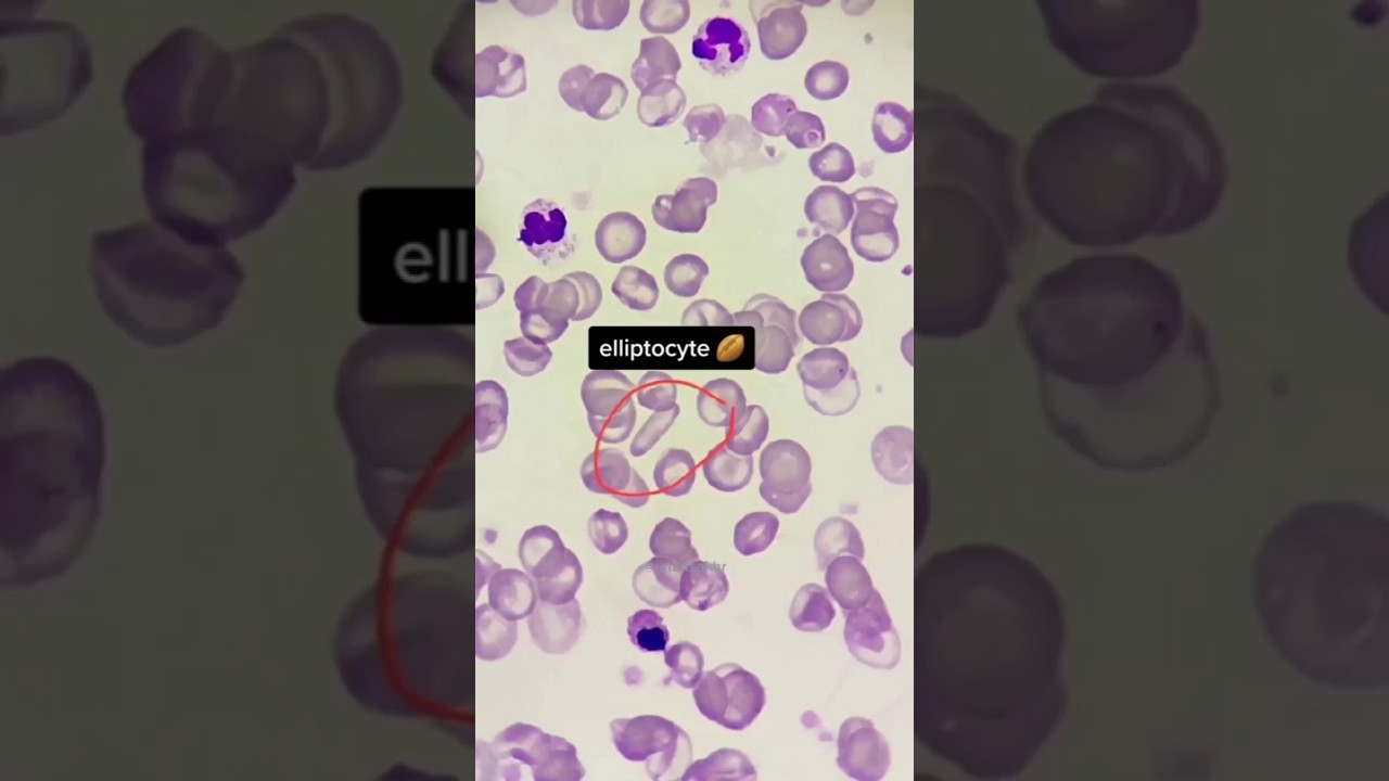 lab technician shorts viral videos 