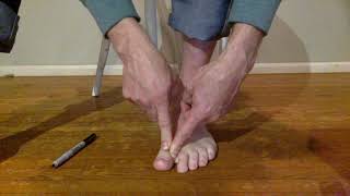 Myofascial Release for Bunions