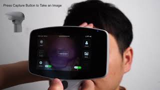 Excellent Non Mydriatic 12 MP Hand Held Fundus Camera with patient management software screenshot 2