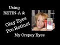 Retin-A | Olay Pro-Retinol Eye Cream On My Mature Crepey Eyes  | Sixty Plus