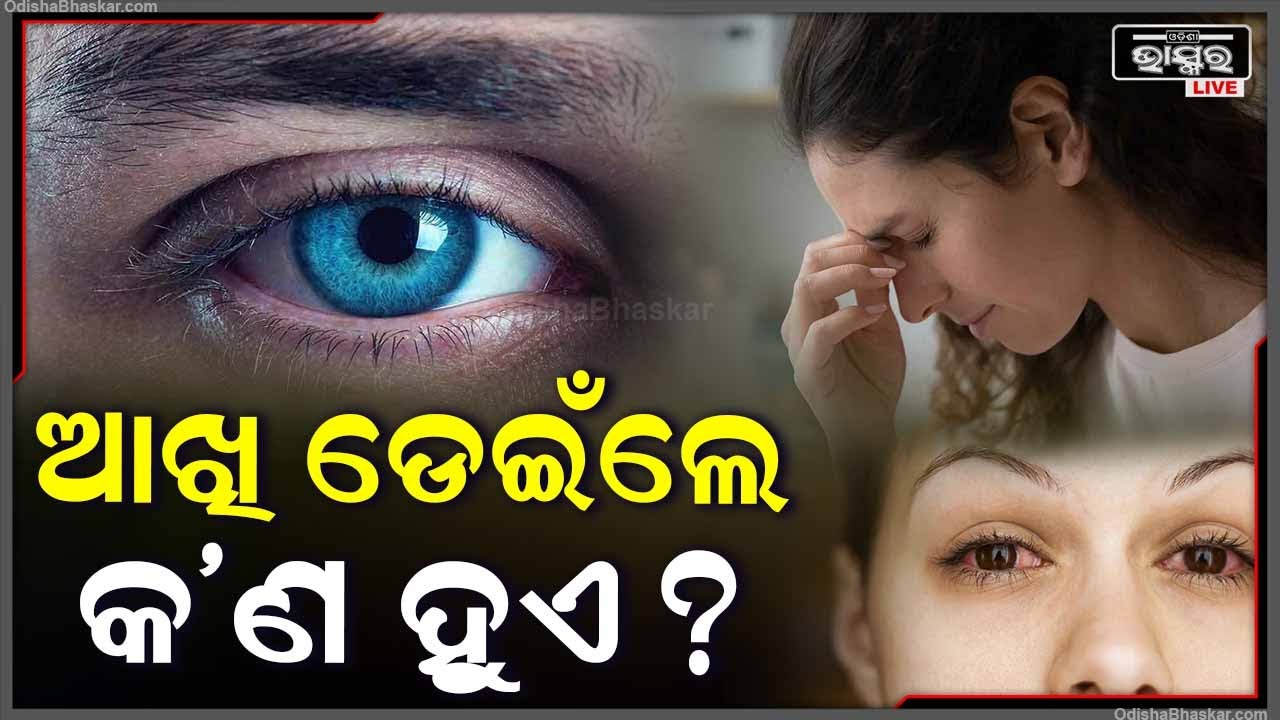ଆଖି ଡେଇଁଲେ ଶୁଭ ନା ଅଶୁଭ ହୋଇଥାଏ | ଭିଡିଓ ଦେଖି ଜାଣନ୍ତୁ ସମ୍ପୂର୍ଣ ତଥ୍ୟ |
