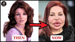Top 10 Shocking Celebrity Cosmetic Disasters You Won’t Believe | Then and Now 2026