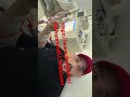 #canada