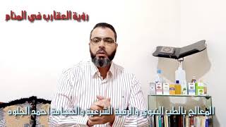 على ماذا تدل رؤية العقارب في المنام