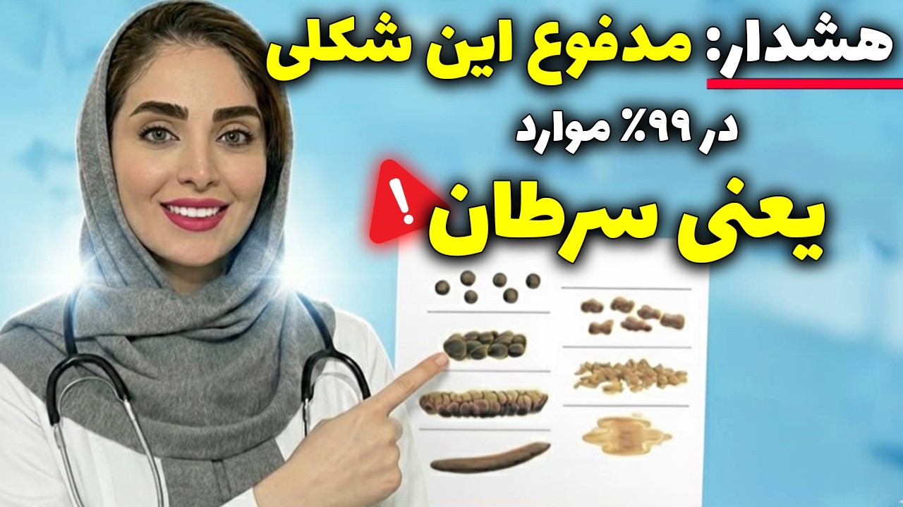 هشدار فوری پزشکان: مدفوع این شکلی در ۹۹٪ موارد نشانه سرطانه !