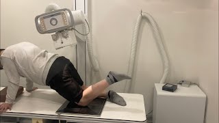 X-ray knee tunnel view position on the table