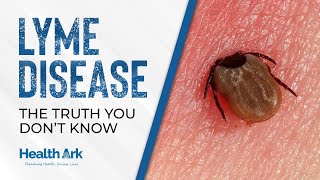 Lyme Disease Myths EXPOSED! What You Need to Know NOW! #lyme #lymediseaseawareness #myths #facts