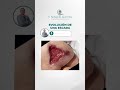 Cura de escaras con productos de alta tecnología