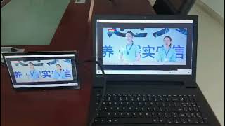 DWIN HDMI 10.1 resolution 1024*600 LCM with HDMI interface