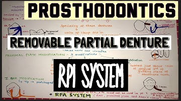 RPI SYSTEM || RPA SYSTEM || SPECIAL TYPE OF REMOVABLE PARTIAL DENTURE || PROSTHODONTICS