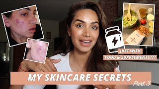 HOW I HEALED MY SKIN WITH FOOD AND SUPPLEMENTS // MY SKINCARE JOURNEY PART 3