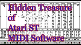 [MIDI/Computer] Hidden Treasure of Atari ST MIDI Software Part 1 - Dr. T's MIDI-AX
