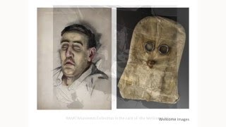 Big Question Lecture - Was the First World War good for medicine?
