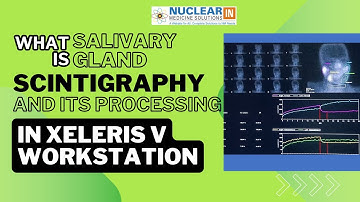 How Xeleris V GE Workstation Enhances Salivary Gland Scintigraphy