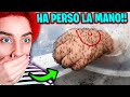 RAGAZZO MORSO DA 1000 ZANZARE..