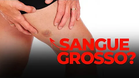 Qual os sintomas do sangue grosso?