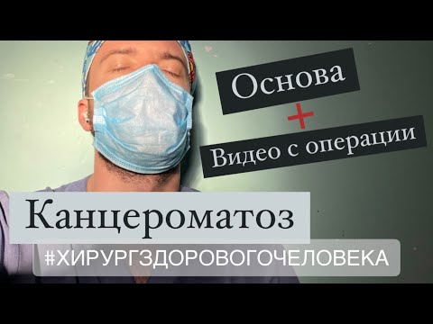 Канцероматоз. Видео с пораженной брюшной полостью. Имплантационная теория. Диагностика.