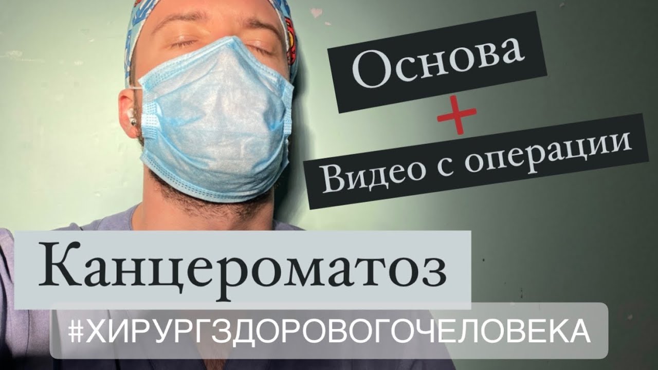 Канцероматоз. Видео с пораженной брюшной полостью. Имплантационная теория. Диагностика.