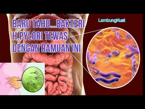 Ramuan pembunuh Bakteri H,Pylori