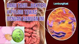 Ramuan pembunuh Bakteri H,Pylori