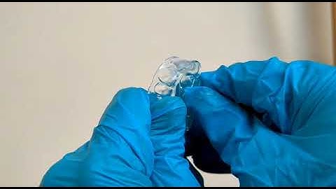 3Dresyns 3D printed aligner printed with 3Dresyn OD-Clear TF LTP Rigid at 0.8 mm