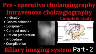 Preoperative Cholangiography Intravenous Cholangiography Ivc Biliary Imaging System Part - 2