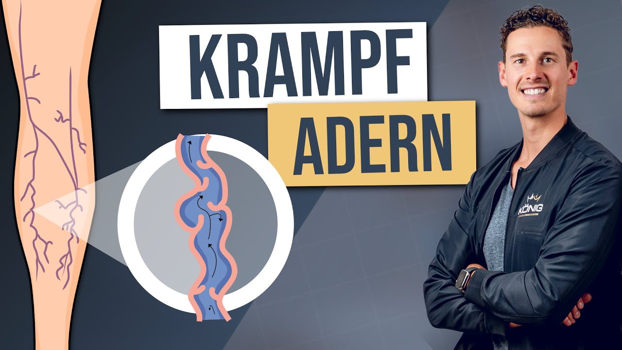 Die Entstehung von Krampfadern