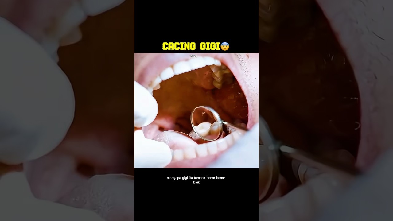 DOKTER GIGI INI KAGET SAAT MENEMUKAN SESUATU DI GIGI PASIENNYA! | Urban Myths: Tooth Worms #film